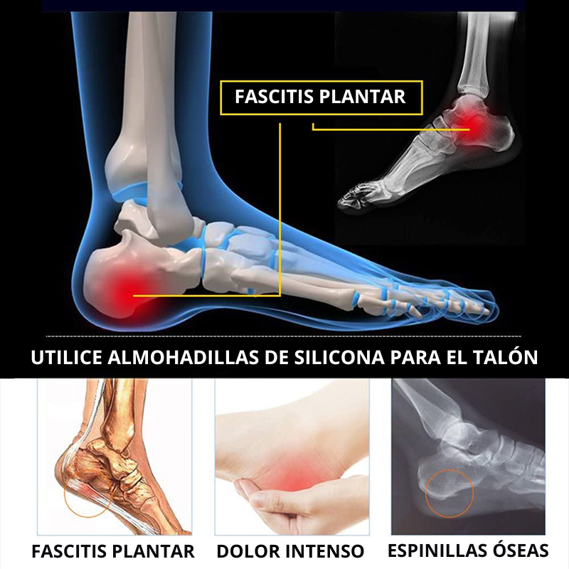 Almohadillas Protectoras Para Fascitis Plantar
